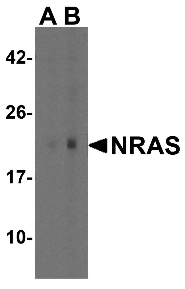 N-Ras Antibody in Western Blot (WB)