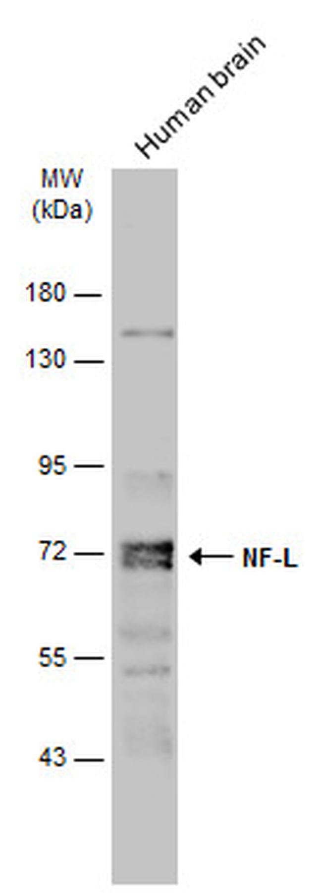 NEFL Antibody in Western Blot (WB)