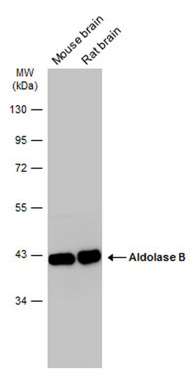 Aldolase B Antibody in Western Blot (WB)