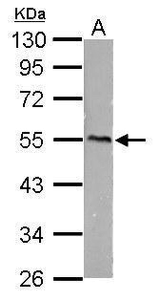 CaMKI gamma Antibody in Western Blot (WB)