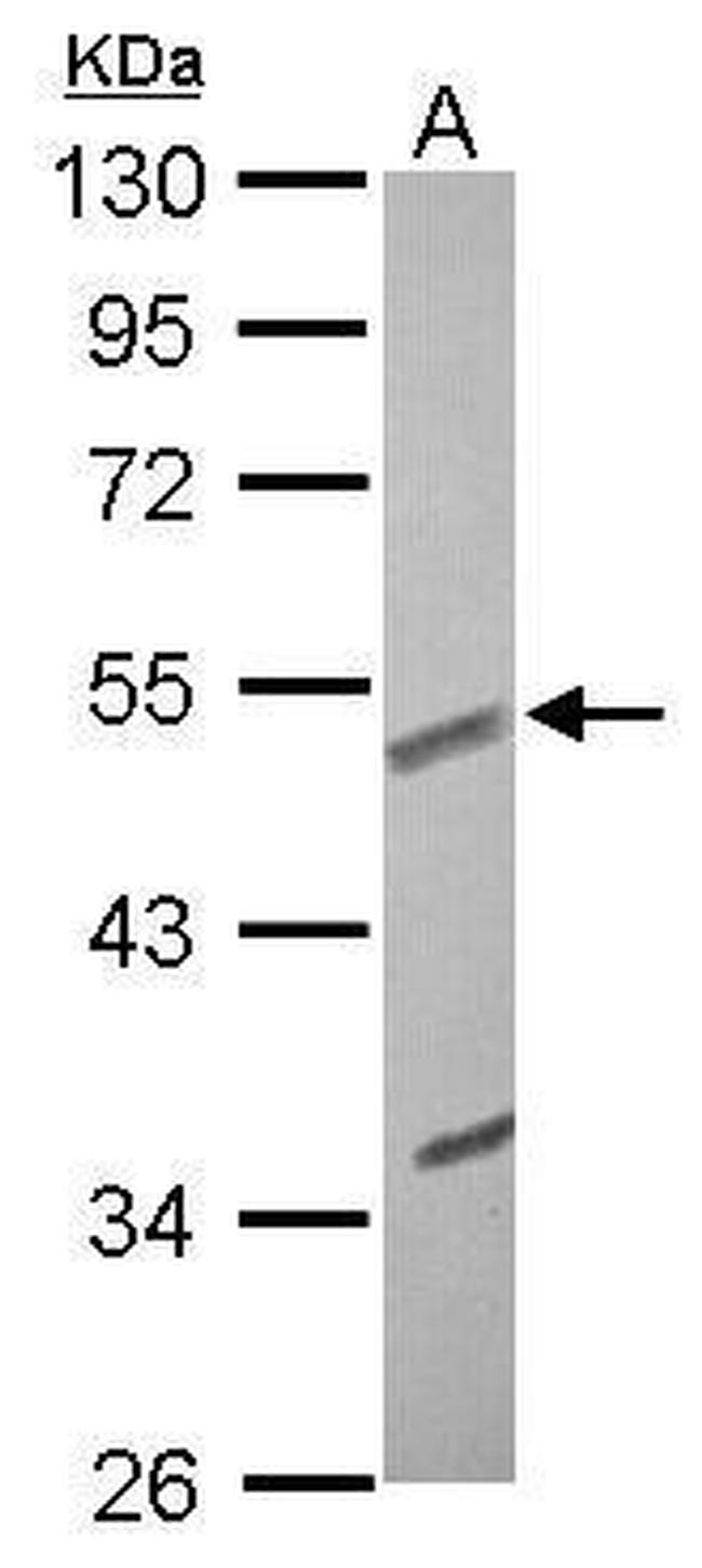 Fibulin 3 Antibody in Western Blot (WB)