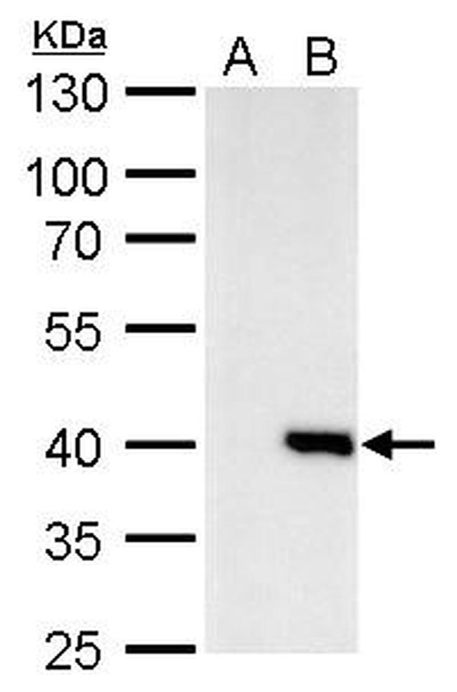 Macro H2A.2 Antibody in Western Blot (WB)
