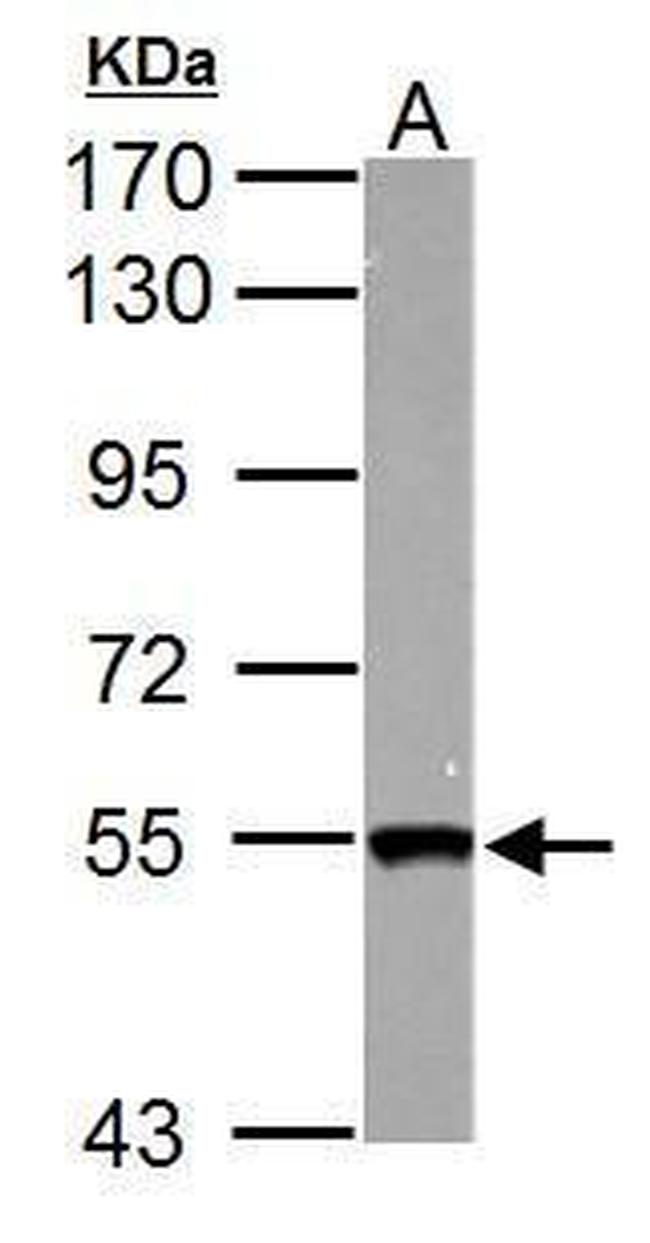 SMYD1 Antibody in Western Blot (WB)