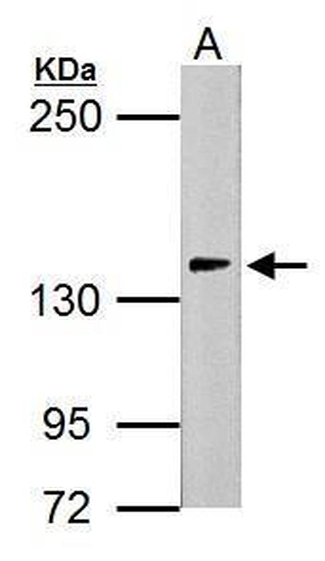 USP7 Antibody in Western Blot (WB)