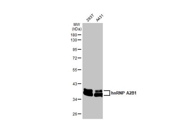 hnRNP A2B1 Antibody in Western Blot (WB)