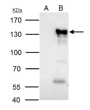 NFATC2 Antibody in Immunoprecipitation (IP)