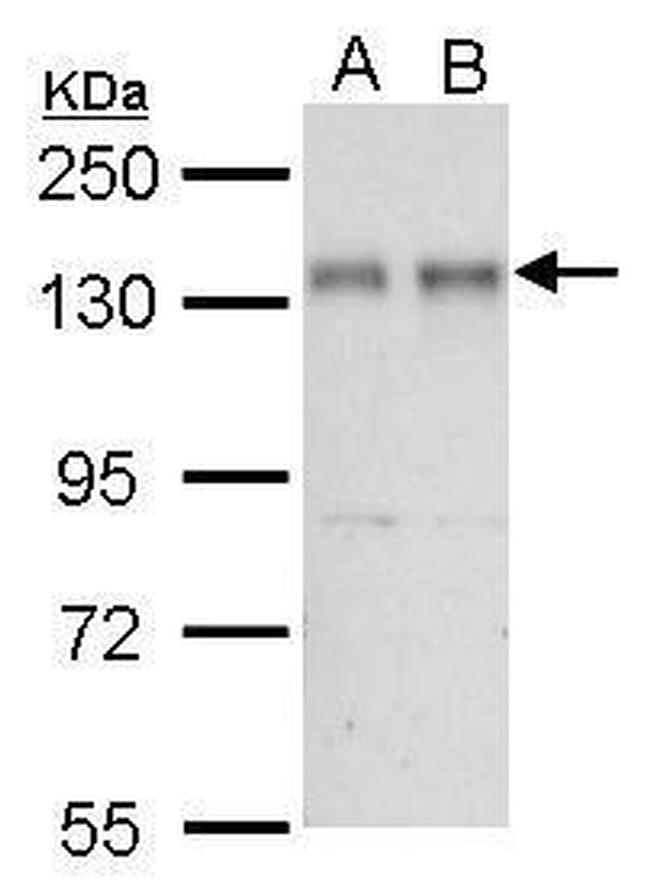 NFATC2 Antibody in Western Blot (WB)