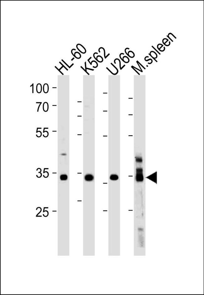 GFI1B Antibody in Western Blot (WB)