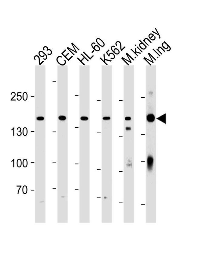 PKP4 Antibody in Western Blot (WB)