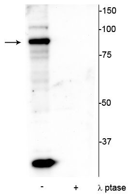 Phospho-ATRIP (Ser239) Antibody in Western Blot (WB)