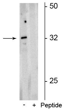 Phospho-OLIG2 (Ser10, Ser13, Ser14) Antibody in Western Blot (WB)