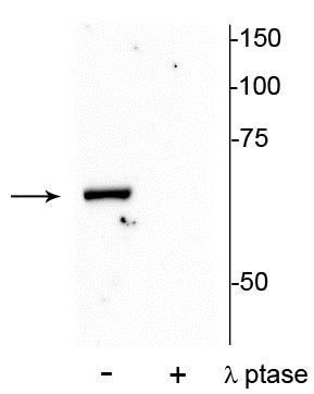 Phospho-PAK1 (Thr84) Antibody in Western Blot (WB)
