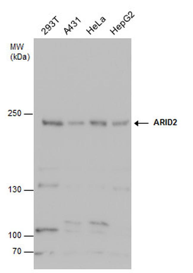 ARID2 Antibody in Western Blot (WB)