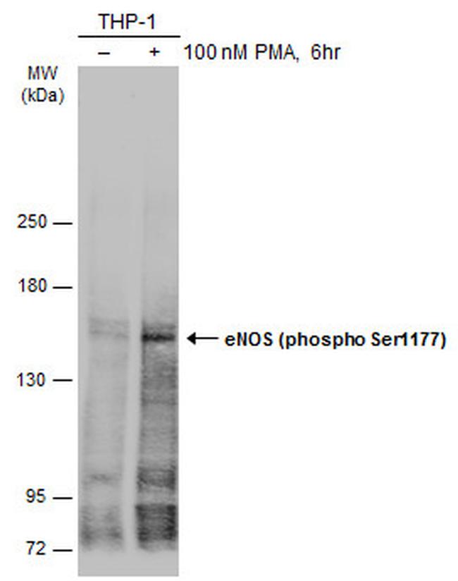 Phospho-eNOS (Ser1177) Antibody in Western Blot (WB)