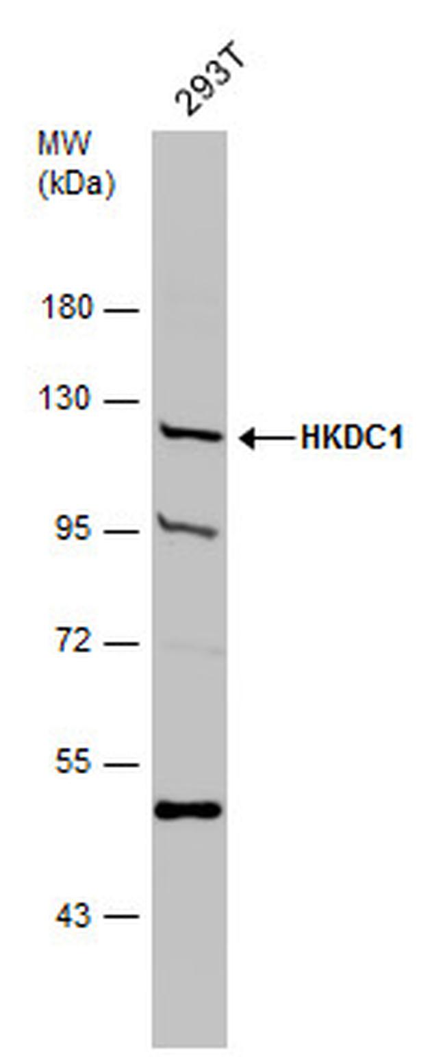 HKDC1 Antibody in Western Blot (WB)
