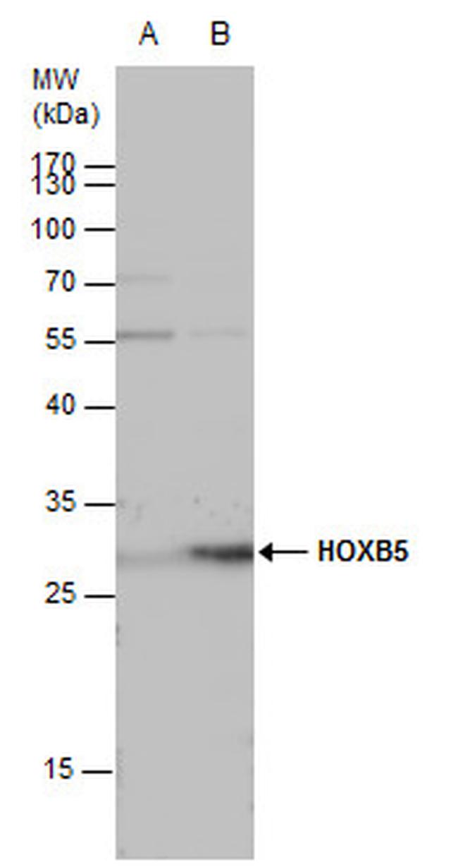 HOXB5 Antibody in Western Blot (WB)