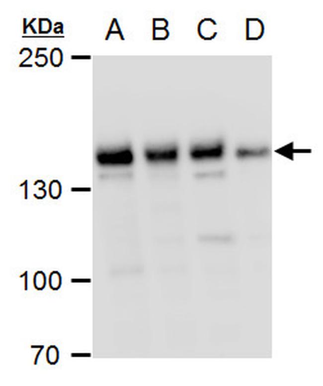 PHF2 Antibody in Western Blot (WB)