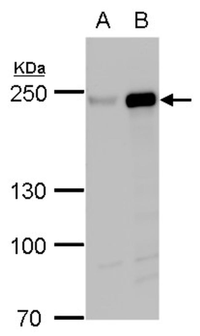 FIP200 Antibody in Western Blot (WB)
