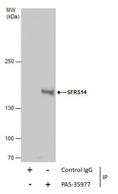 SUGP2 Antibody in Immunoprecipitation (IP)