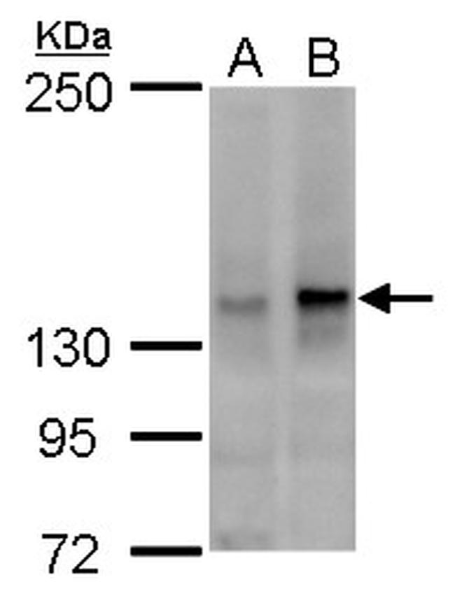 SUGP2 Antibody in Western Blot (WB)
