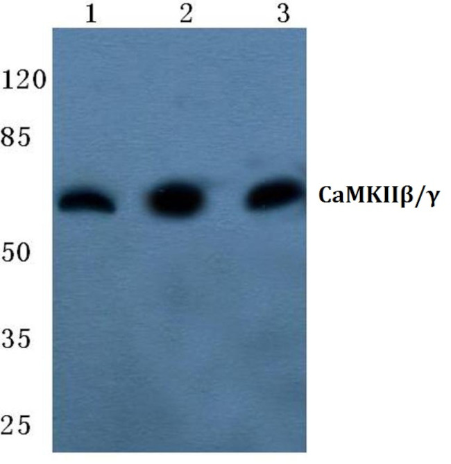 CaMKII beta/gamma Antibody in Western Blot (WB)