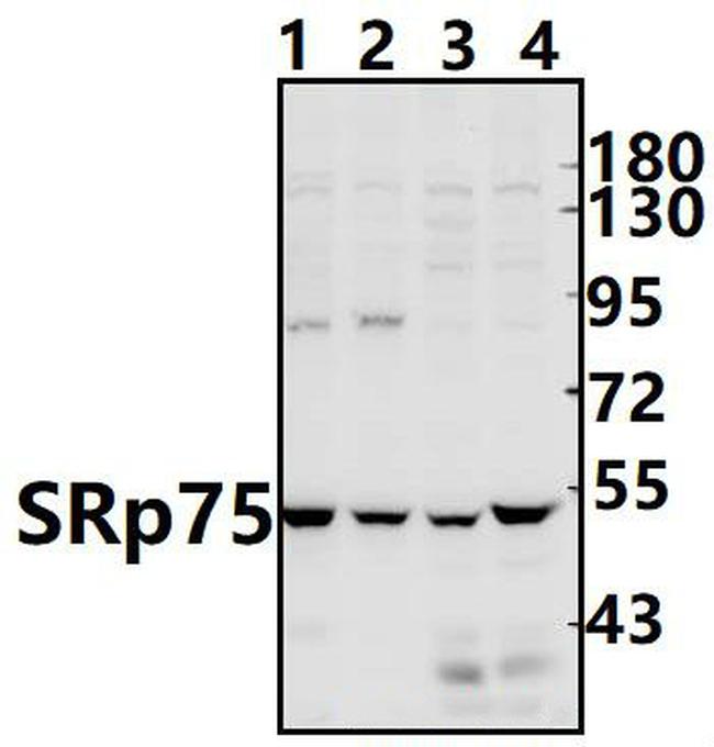 SRSF4 Antibody in Western Blot (WB)