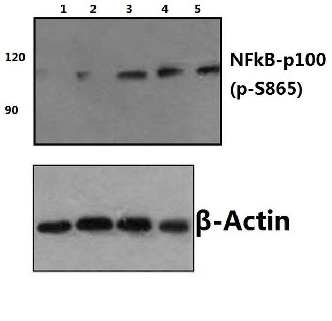 Phospho-NFkB p100 (Ser866) Antibody in Western Blot (WB)