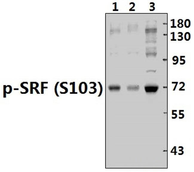 Phospho-SRF (Ser103) Antibody in Western Blot (WB)