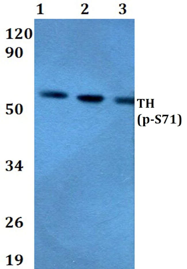 Phospho-Tyrosine Hydroxylase (Ser71) Antibody in Western Blot (WB)