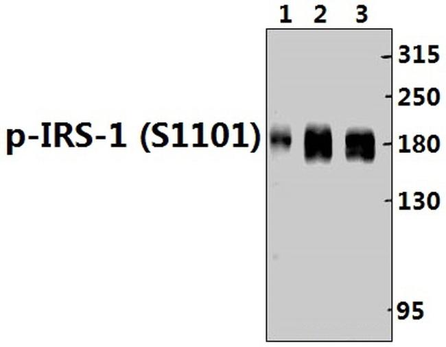 Phospho-IRS1 (Ser1101) Antibody in Western Blot (WB)