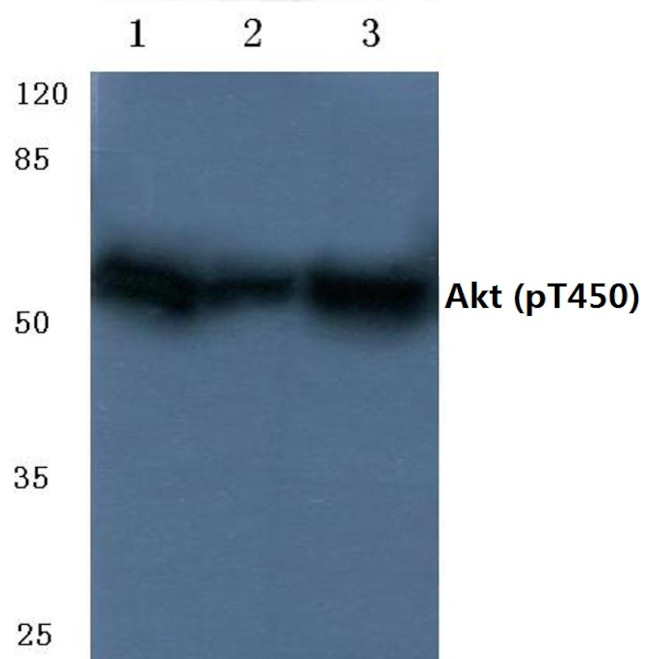 Phospho-AKT Pan (Thr450, Thr451, Thr447) Antibody in Western Blot (WB)