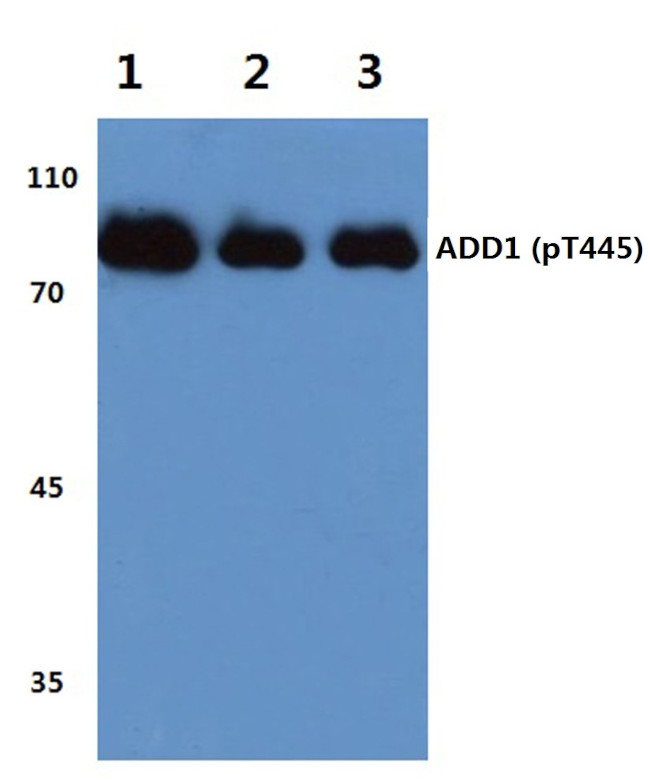 Phospho-alpha Adducin (Thr445) Antibody in Western Blot (WB)