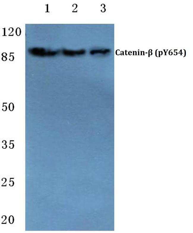 Phospho-beta Catenin (Tyr654) Antibody in Western Blot (WB)