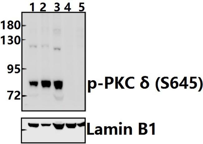 Phospho-PKC delta (Ser645) Antibody in Western Blot (WB)