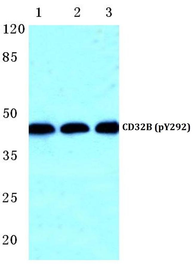 Phospho-FCGR2B (Tyr292) Antibody in Western Blot (WB)