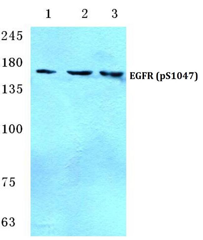 Phospho-EGFR (Ser1047) Antibody in Western Blot (WB)