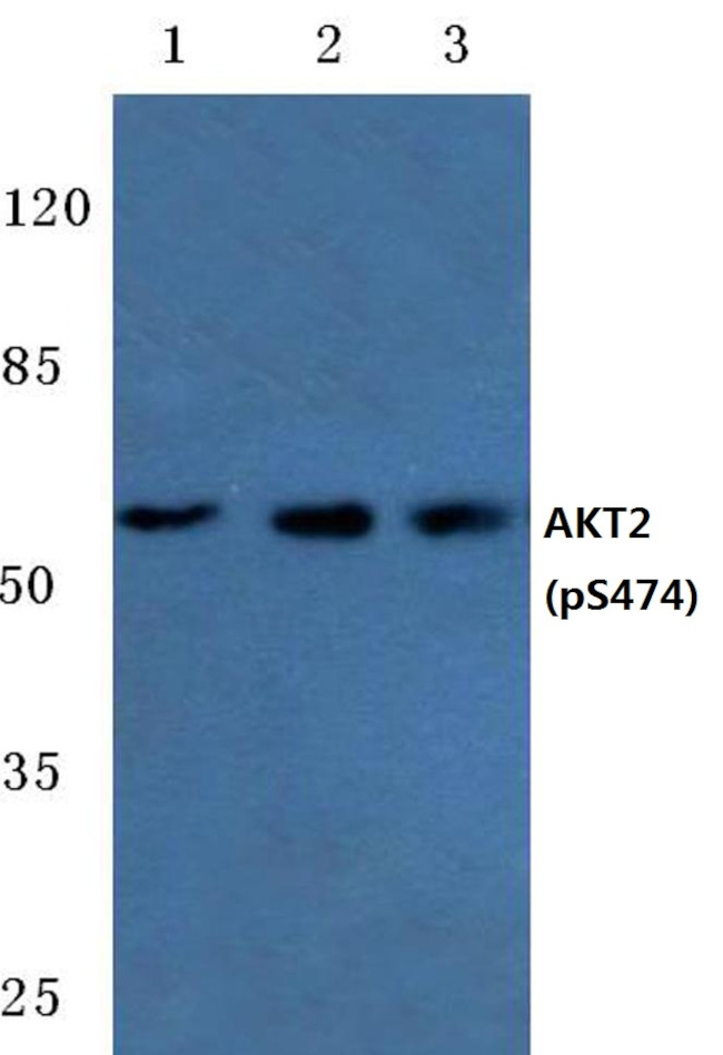 Phospho-AKT2 (Ser474) Antibody in Western Blot (WB)