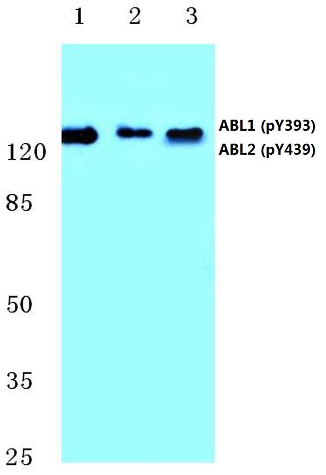 Phospho-ABL1/ABL2 (Tyr393, Tyr439) Antibody in Western Blot (WB)