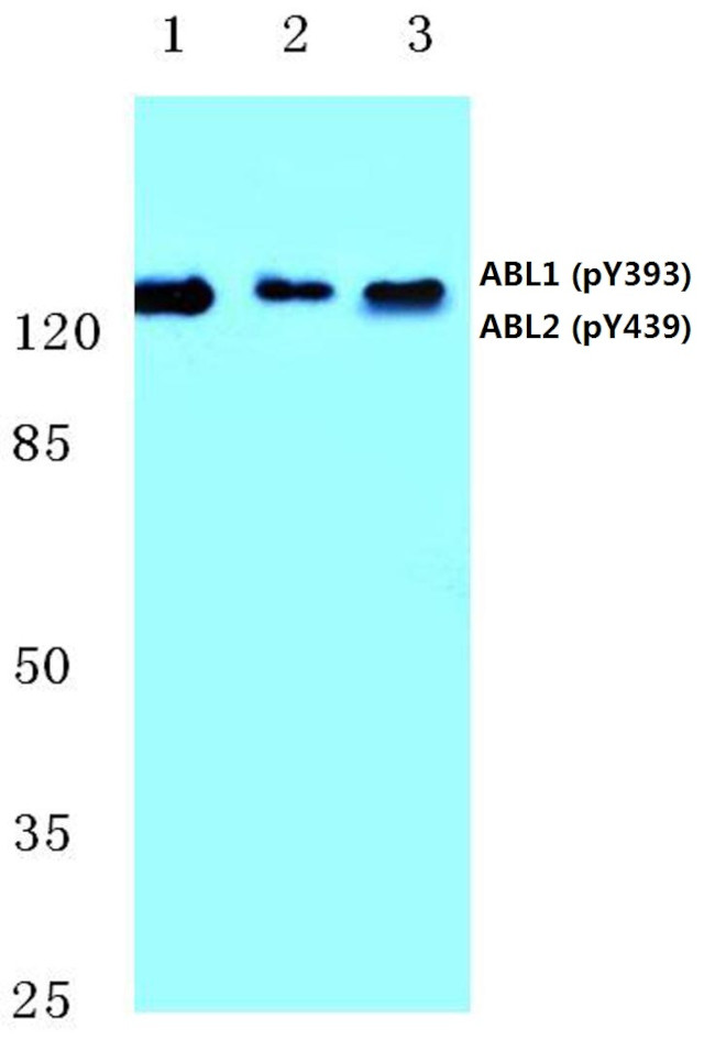 Phospho-ABL1/ABL2 (Tyr393, Tyr439) Antibody in Western Blot (WB)