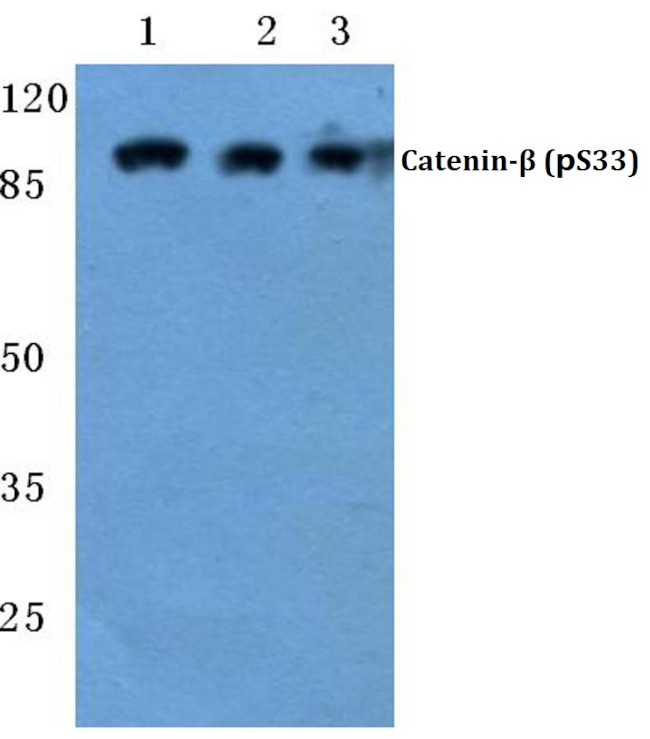 Phospho-beta Catenin (Ser33) Antibody in Western Blot (WB)