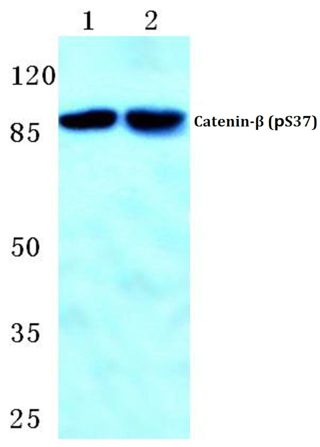 Phospho-beta Catenin (Ser37) Antibody in Western Blot (WB)