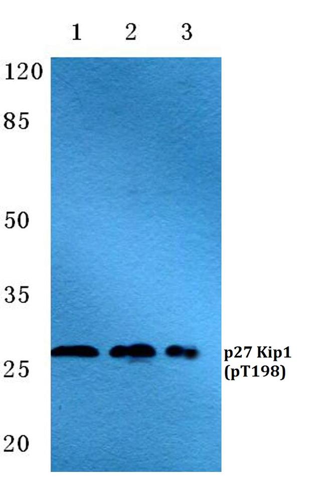 Phospho-p27 Kip1 (Thr198) Antibody in Western Blot (WB)