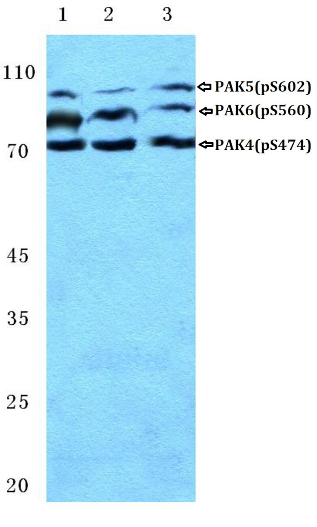 Phospho-PAK4/6/7 (Ser474) Antibody in Western Blot (WB)
