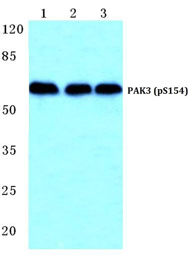 Phospho-PAK3 (Ser154) Antibody in Western Blot (WB)