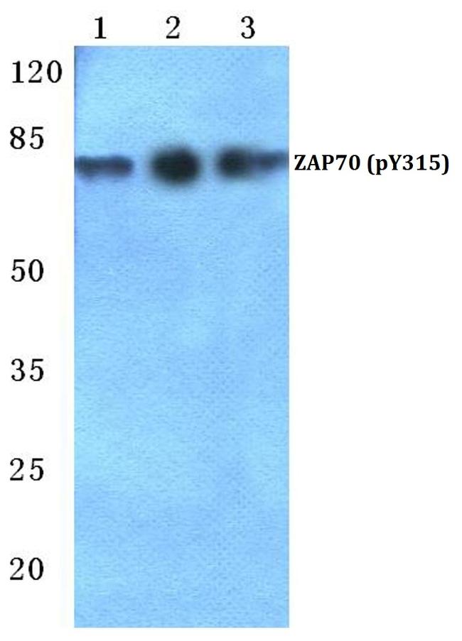 Phospho-Zap-70 (Tyr315) Antibody in Western Blot (WB)