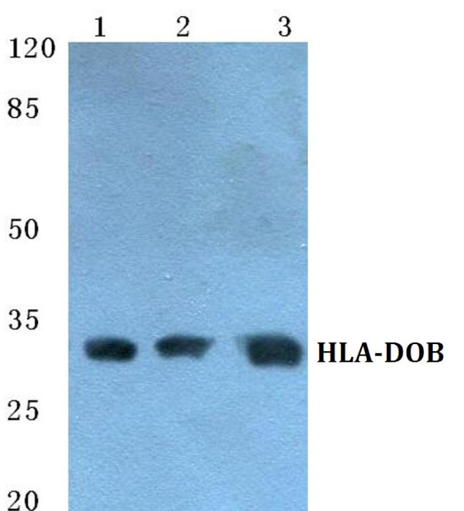 HLA-DOB Antibody in Western Blot (WB)