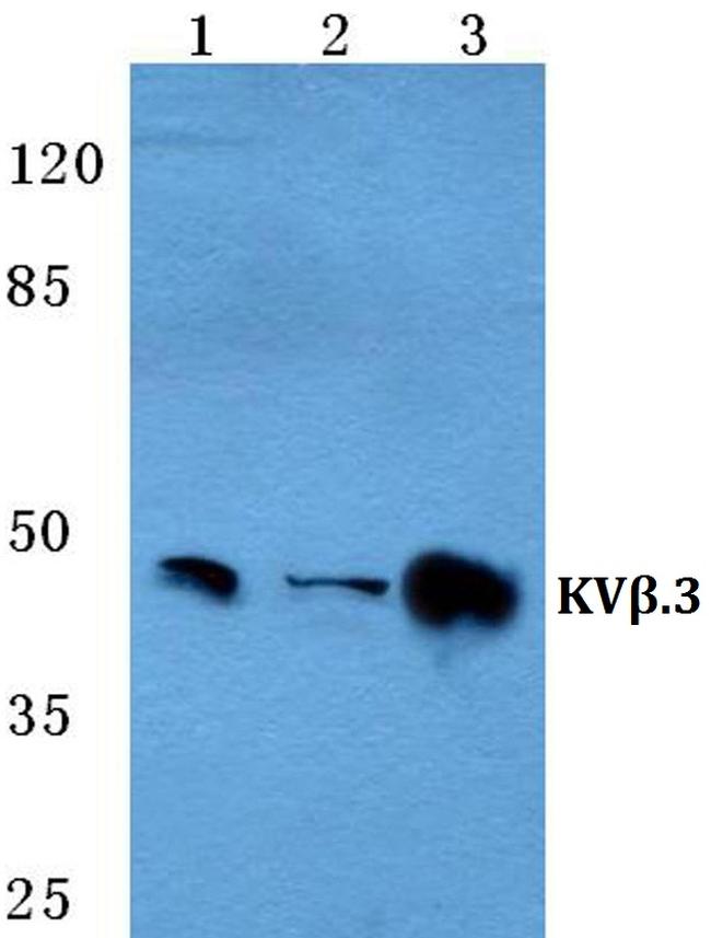 KCNAB3 Antibody in Western Blot (WB)
