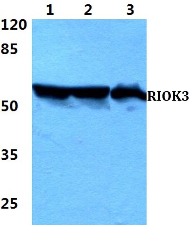 RIOK3 Antibody in Western Blot (WB)