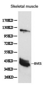 BVES Antibody in Western Blot (WB)