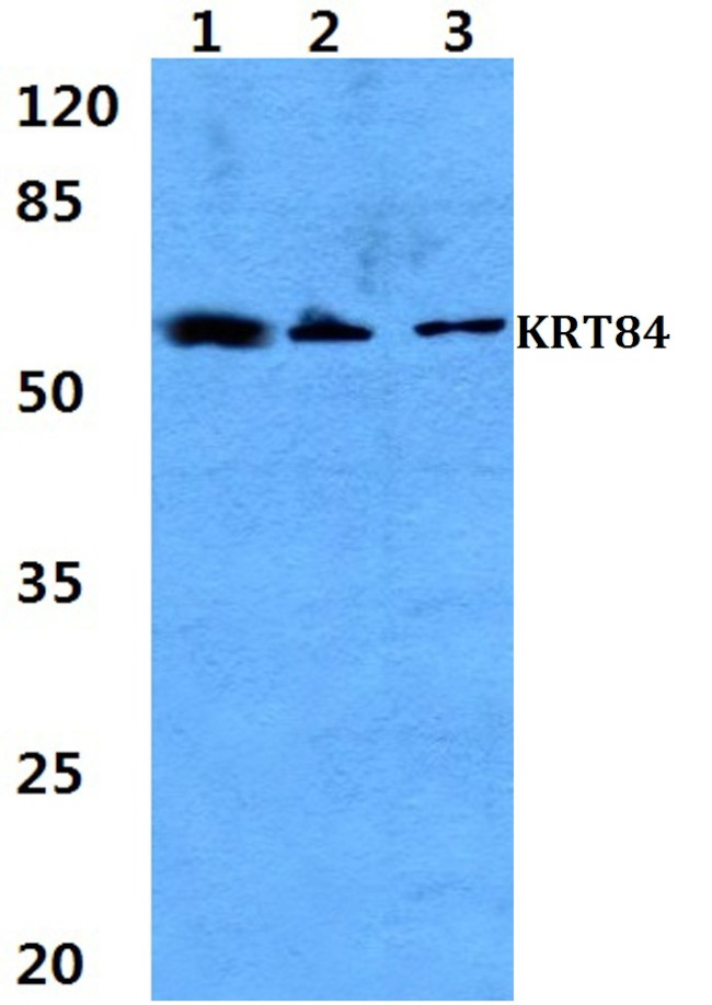 KRT84 Antibody in Western Blot (WB)